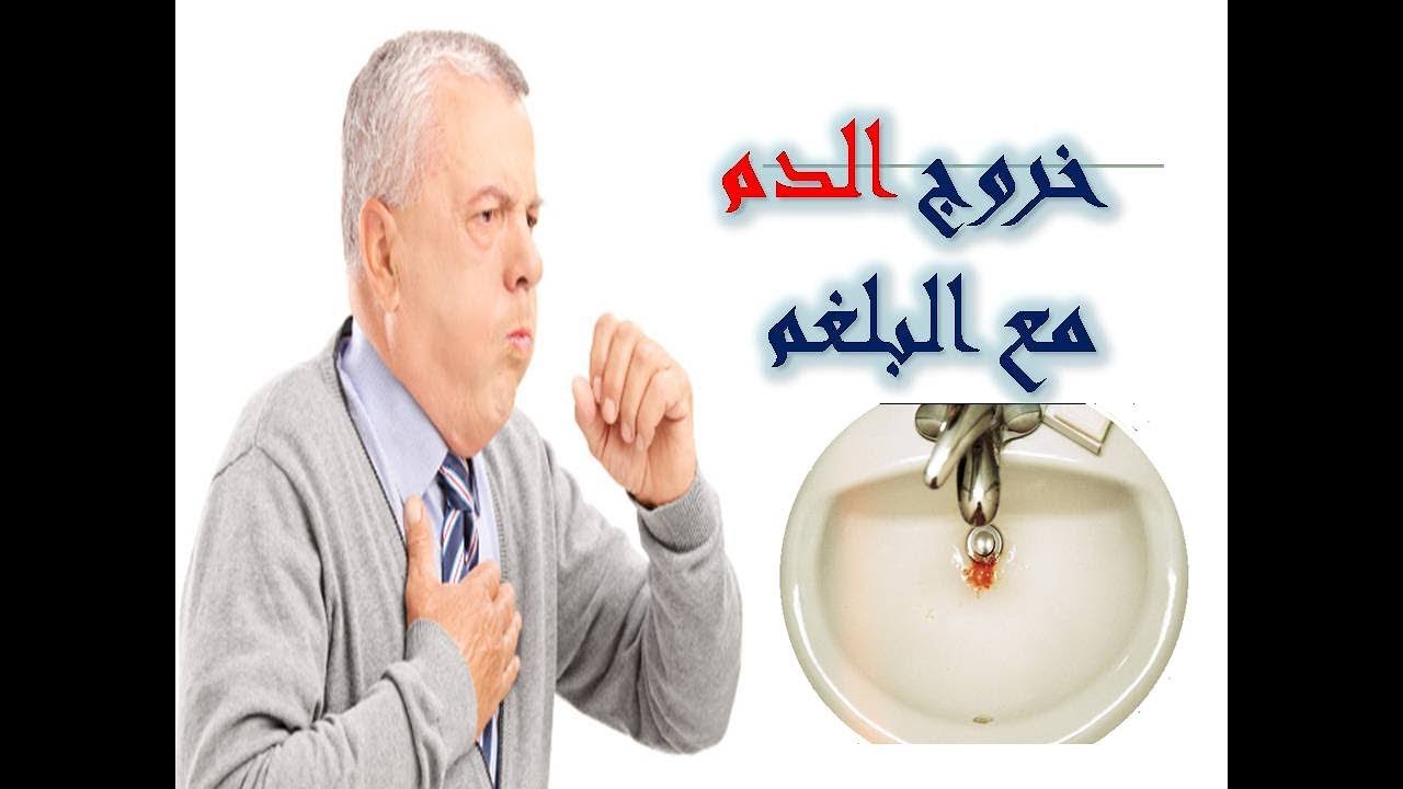 خروج دم مع البلغم - امراض تخطف القلب 9568 11