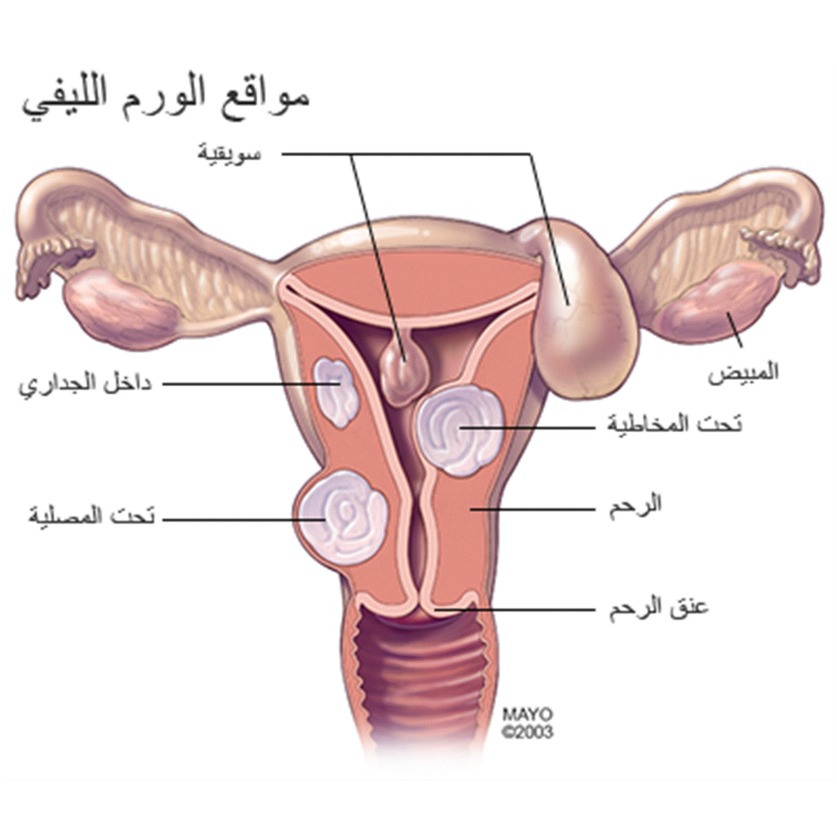 اسباب استئصال الرحم - هذا السبب يؤدى الى استئصال الرحم 9458 2