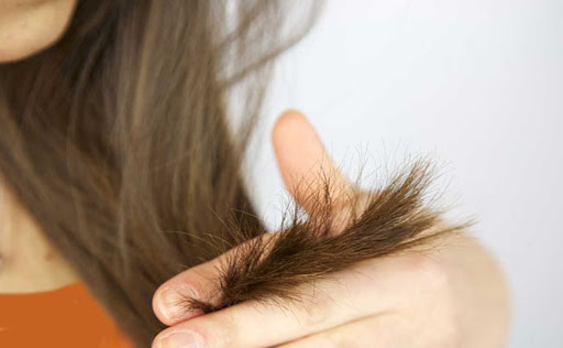 778 1 علاج تقصف الشعر - سر جاذبية شعرك زاوية التامل